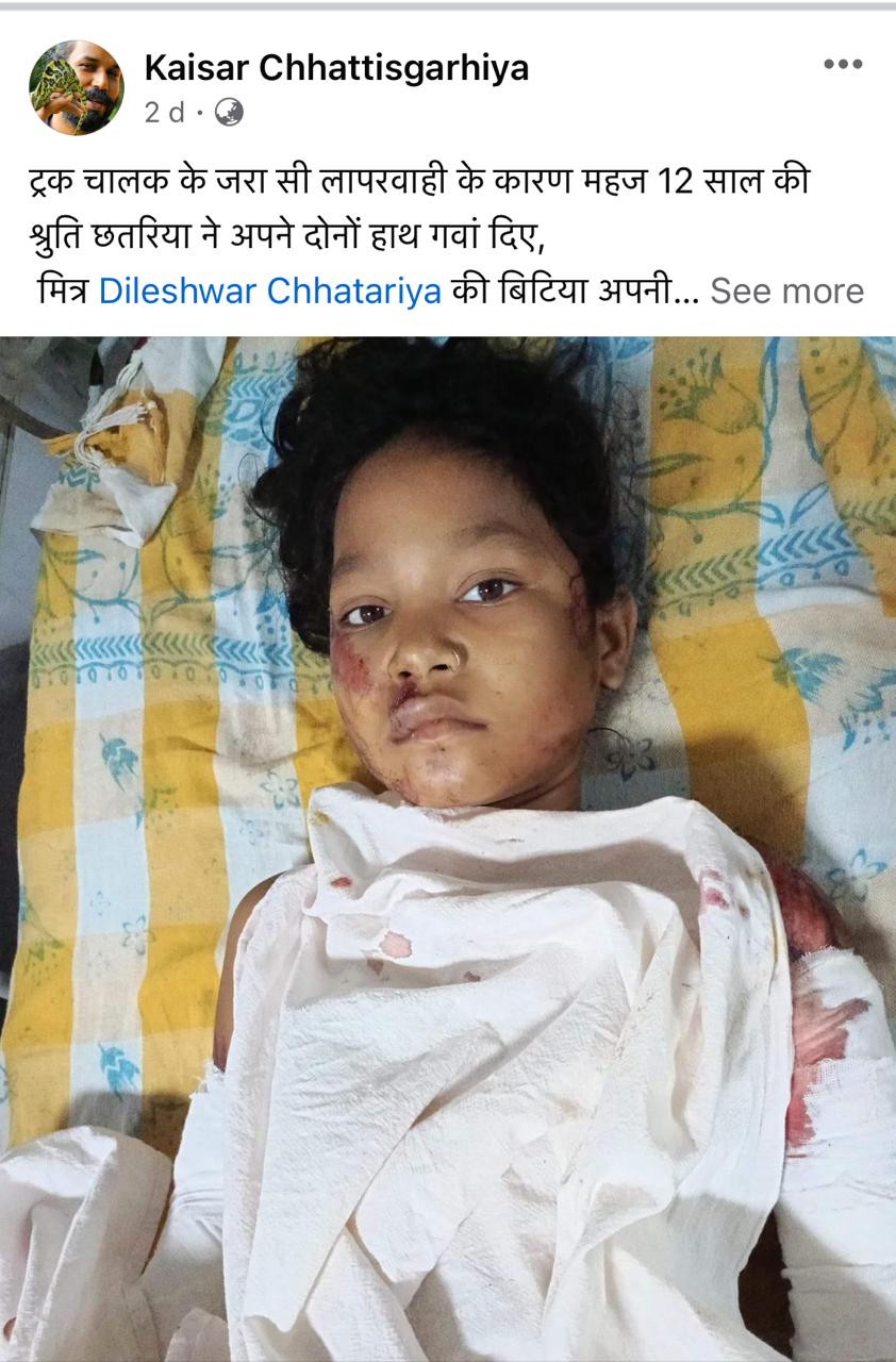 हादसे ने हाथ छीने ,तो 12 साल की बच्ची के मदत के लिए सैकड़ों हाथ हुए खड़े